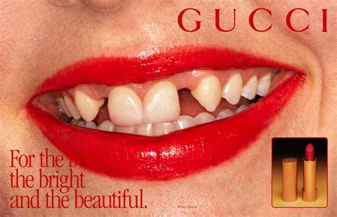 gucci model with bad teeth